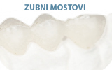 Zubni mostovi