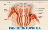 Parodontopatija